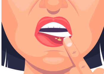 HOW TO TREAT VULVITIS WITH HOMEOPATHIC MEDICINES